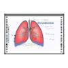 Tabla interactiva 95 EVOBOARD IB-95Q6, 16:10/16:9 tehnologie tactila IR, 10 puncte de atingere